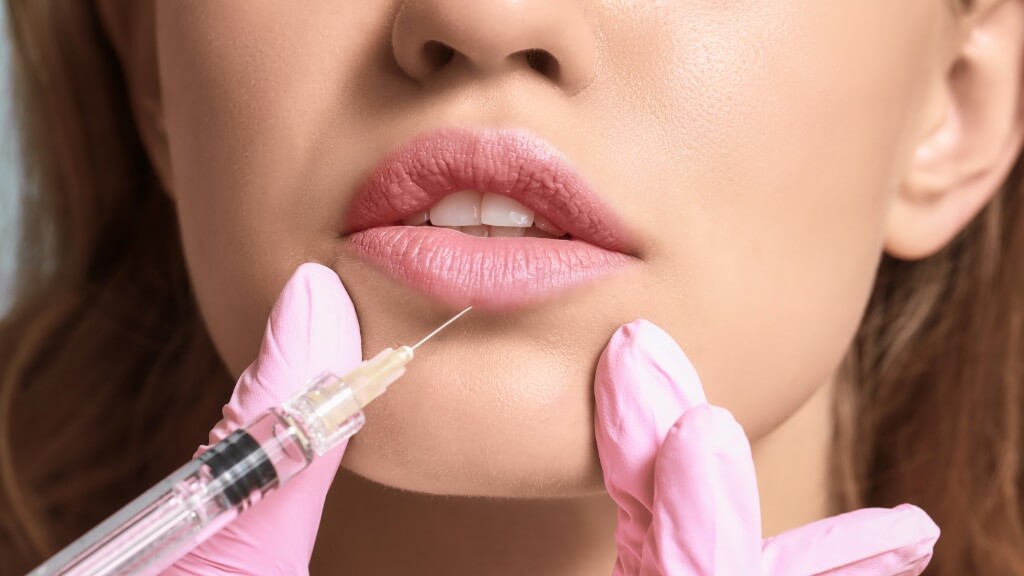 Lip Fillers and Lip Enhancement in Dubai