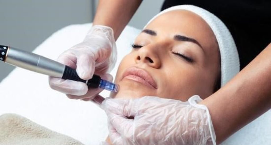 Exosomes For Face With Microneedling