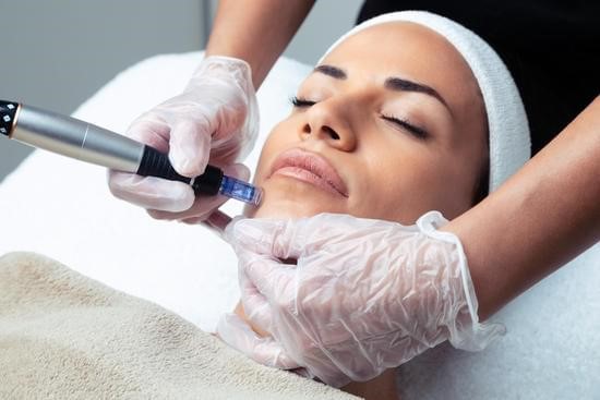 Microneedling with exosomes treatment in DUBAI