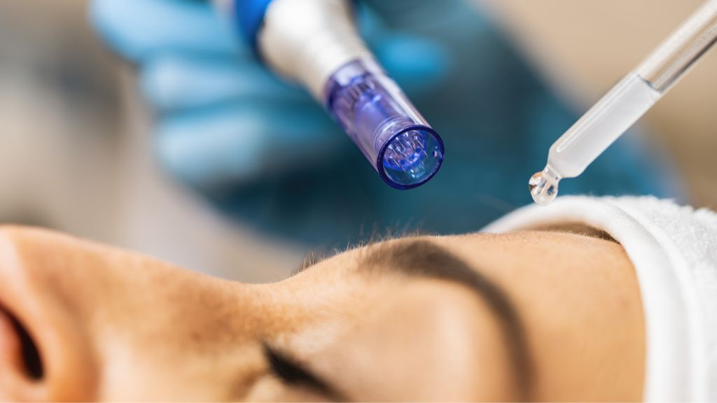 Dermapen treatment in Dubai
