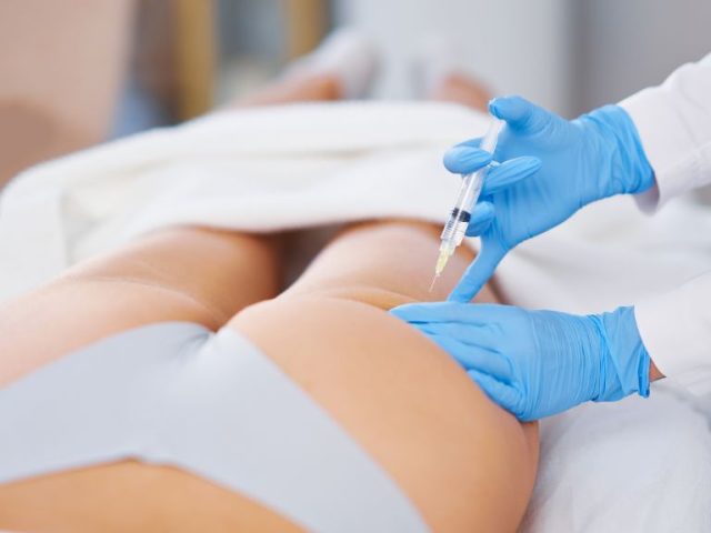 Surgical vs. Non-Surgical Butt Lift: Which Procedure is Right for You?